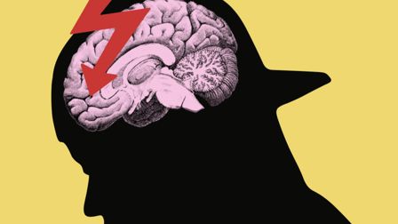The disadvantaged creative brain