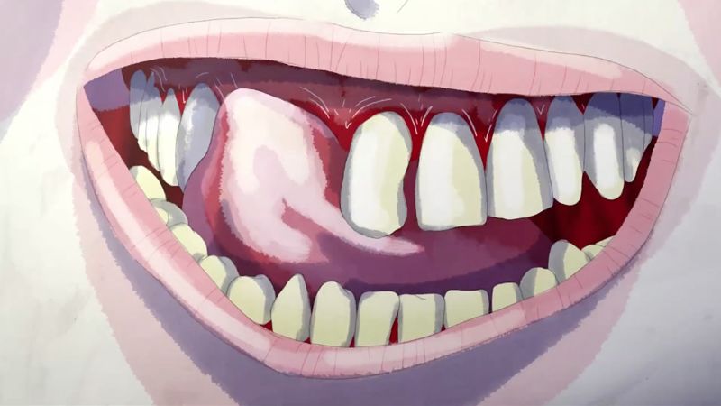 Teeth Trailer